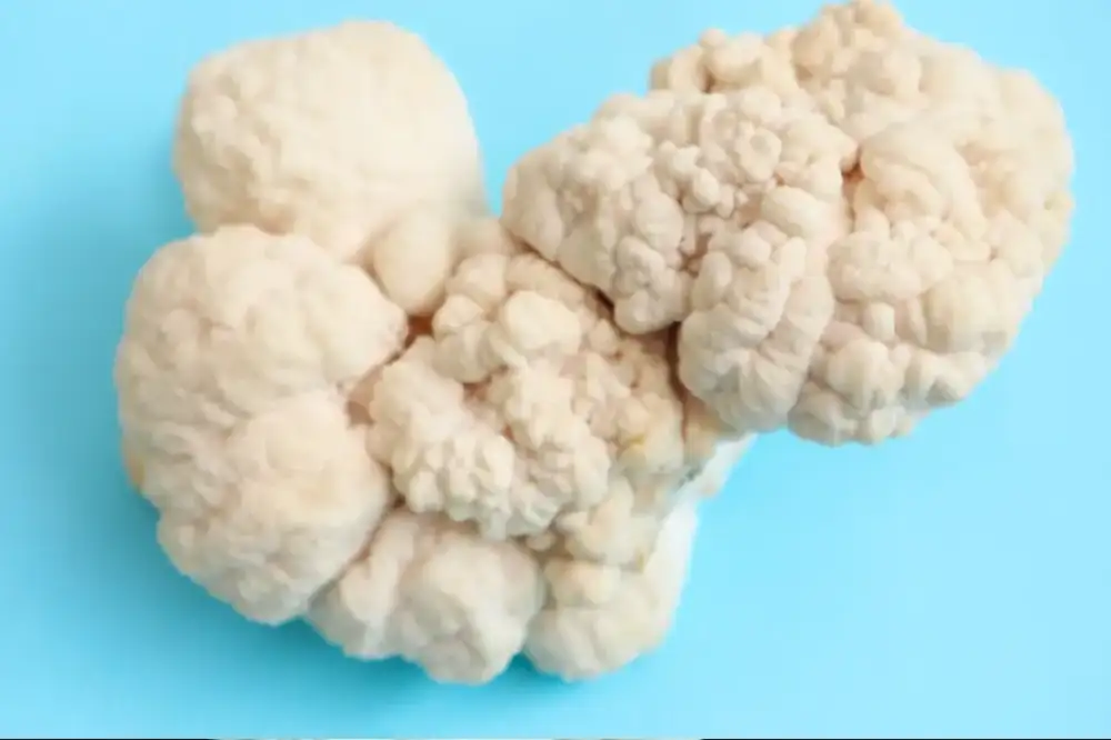 Las distintas especies del género Hericium comparten espinas colgantes pero crecen en ecosistemas distintos